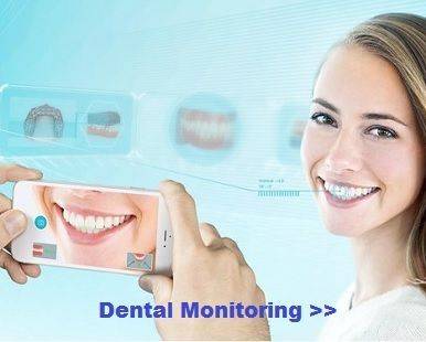 Dental Monitoring